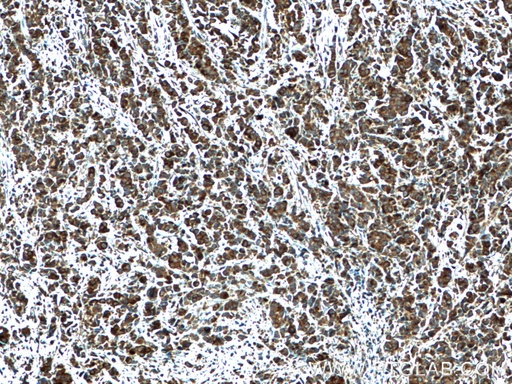 [14847-1-AP-20UL] CRISP3 Polyclonal antibody