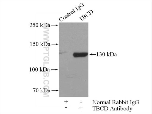 [14867-1-AP-150UL] TBCD Polyclonal antibody
