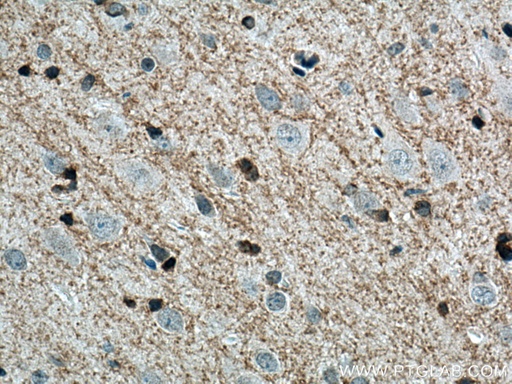[14868-1-AP-150UL] Plasmolipin Polyclonal antibody