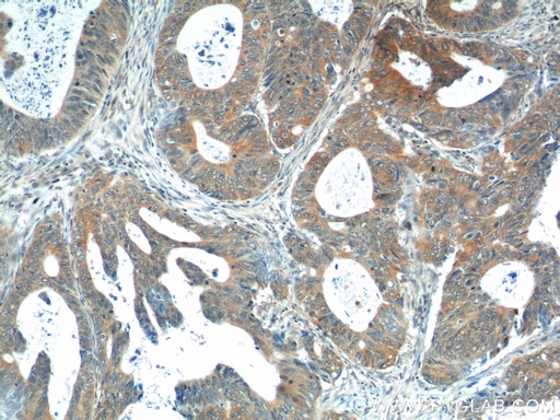 [14869-1-AP-20UL] Calcipressin 1 Polyclonal antibody