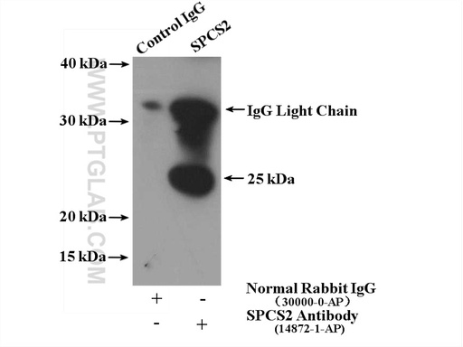 [14872-1-AP-20UL] SPCS2 Polyclonal antibody