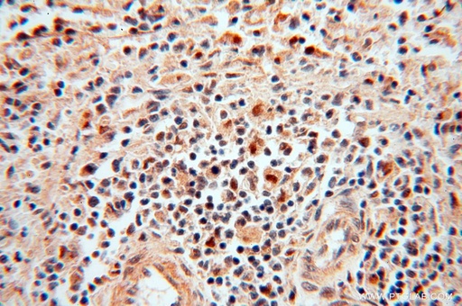 [14873-1-AP-20UL] POLM Polyclonal antibody