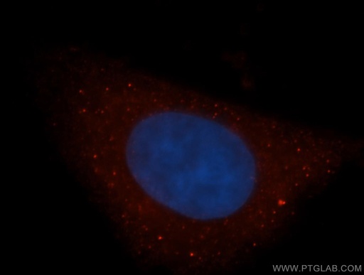 [14876-1-AP-20UL] DAAM1 Polyclonal antibody