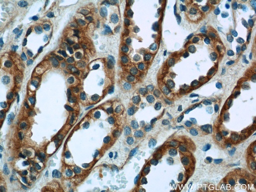 [14878-1-AP-20UL] VIPR1 Polyclonal antibody