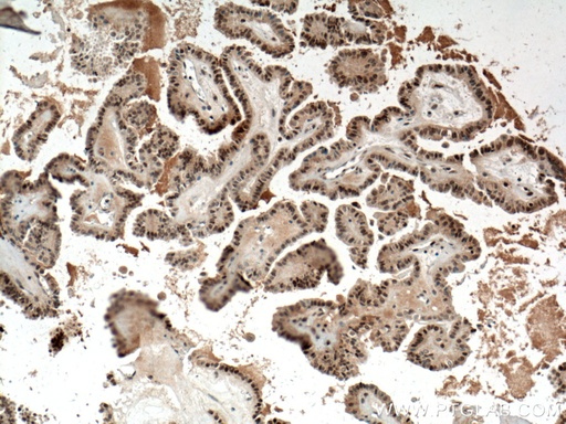 [14879-1-AP-20UL] BTG1 Polyclonal antibody