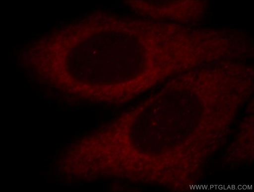 [14884-1-AP-20UL] Aldolase C Polyclonal antibody