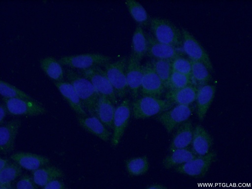[14886-1-AP-20UL] GOT1 Polyclonal antibody