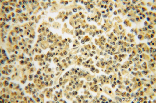 [14894-1-AP-150UL] RPS10 Polyclonal antibody