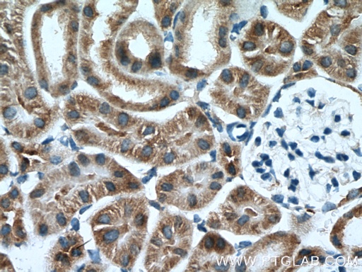 [14900-1-AP-20UL] AARSD1 Polyclonal antibody
