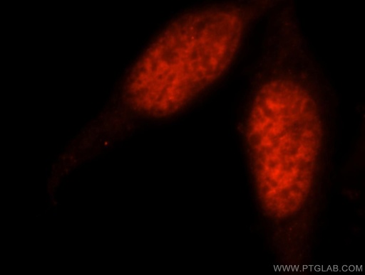 [14907-1-AP-150UL] PSME3 Polyclonal antibody