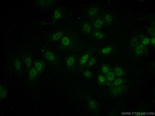 [14917-1-AP-20UL] MEPCE Polyclonal antibody
