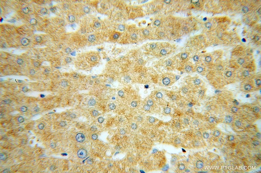 [14923-1-AP-20UL] SUCLG1 Polyclonal antibody
