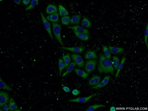 [14925-1-AP-150UL] CNDP2 Polyclonal antibody