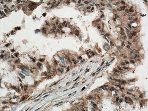 [14926-1-AP-20UL] ANAPC5 Polyclonal antibody