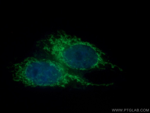 [14927-1-AP-150UL] TIM22 Polyclonal antibody