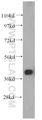 [14928-1-AP-20UL] FAH Polyclonal antibody