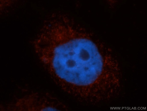 [14931-1-AP-150UL] GNPAT Polyclonal antibody