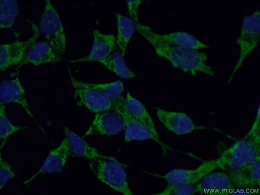 [14932-1-AP-150UL] MECR Polyclonal antibody