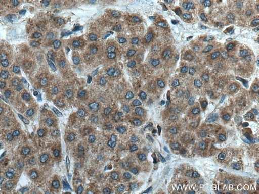 [14933-1-AP-150UL] GALNS Polyclonal antibody