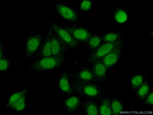 [14950-1-AP-20UL] SNIP1 Polyclonal antibody