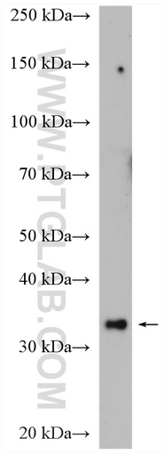 [14953-1-AP-150UL] SNX11 Polyclonal antibody
