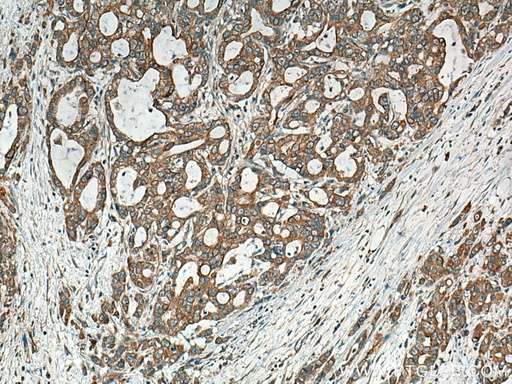 [14956-1-AP-20UL] BEGAIN Polyclonal antibody