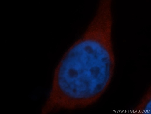 [14957-1-AP-150UL] RPS15 Polyclonal antibody