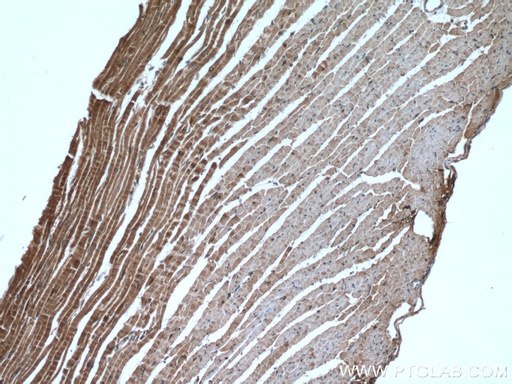[14978-1-AP-150UL] AK1 Polyclonal antibody