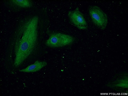 [14981-1-AP-20UL] ASMTL Polyclonal antibody