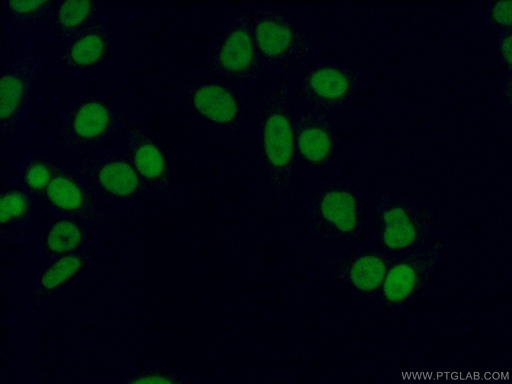 [14994-1-AP-20UL] METTL1 Polyclonal antibody