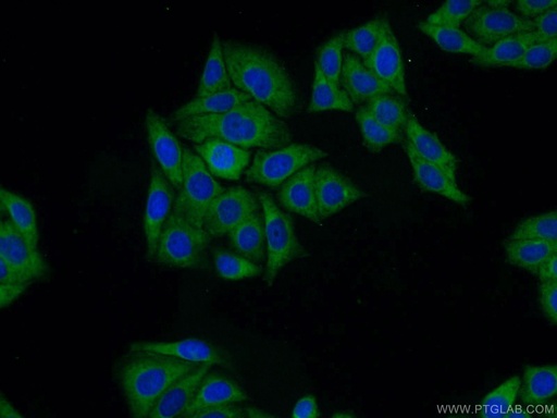 [14995-1-AP-20UL] DDA1 Polyclonal antibody
