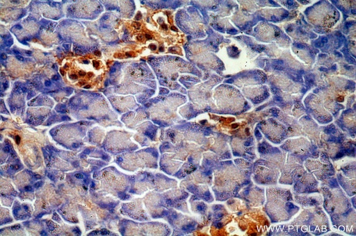 [15007-1-AP-20UL] ENC1 Polyclonal antibody
