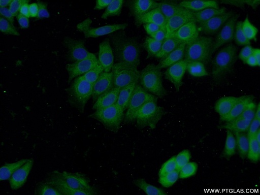 [15016-1-AP-20UL] DNPEP Polyclonal antibody