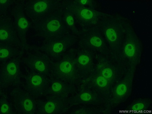 [15021-1-AP-20UL] CITED2 Polyclonal antibody