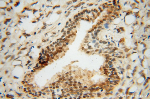 [15037-1-AP-150UL] RING1 Polyclonal antibody