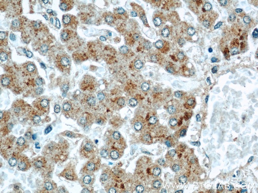 [15039-1-AP-20UL] CMTM8 Polyclonal antibody