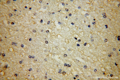[15041-1-AP-20UL] APLP2 Polyclonal antibody