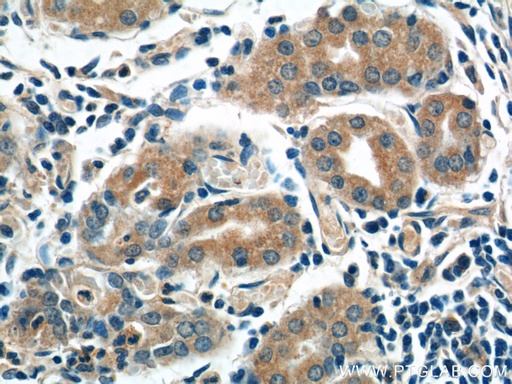 [15042-1-AP-20UL] AZI2/NAP1 Polyclonal antibody