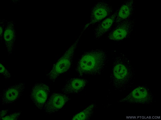 [15045-1-AP-150UL] MAGEA8 Polyclonal antibody