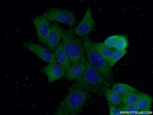 [15054-1-AP-20UL] AKR1A1 Polyclonal antibody