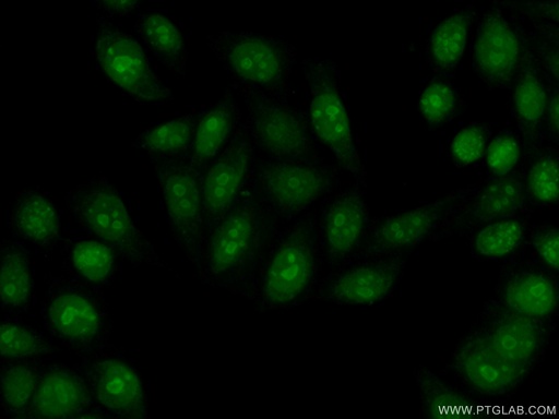 [15062-1-AP-20UL] EXOSC3 Polyclonal antibody