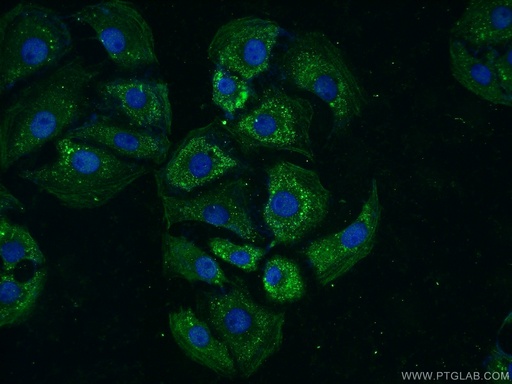[15072-1-AP-20UL] TTBK2 Polyclonal antibody