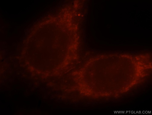 [15074-1-AP-150UL] PI4K2B Polyclonal antibody