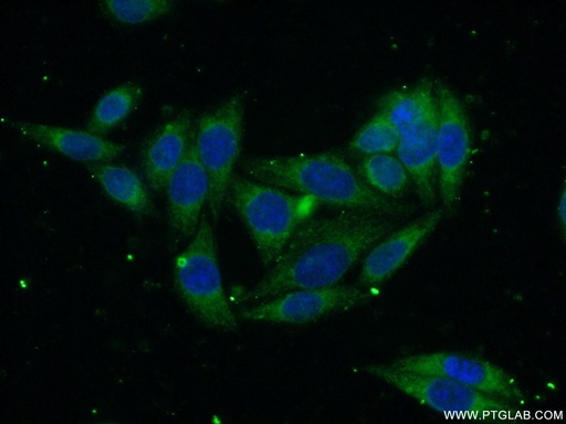 [15087-1-AP-20UL] SEC61B Polyclonal antibody