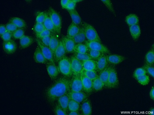 [15091-1-AP-20UL] ANTXR1 Polyclonal antibody