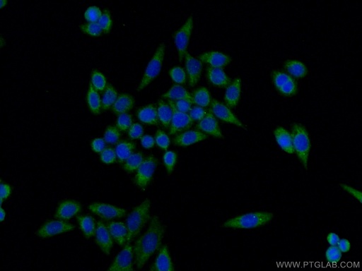 [15104-1-AP-150UL] TNIP1 Polyclonal antibody