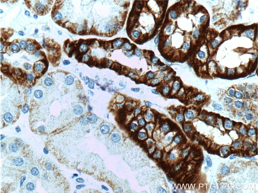 [15107-1-AP-20UL] Cadherin-16 Polyclonal antibody