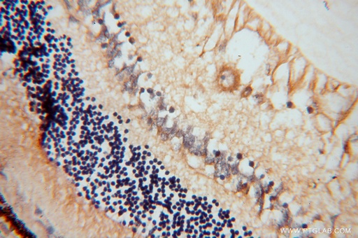 [15108-1-AP-150UL] AIPL1 Polyclonal antibody