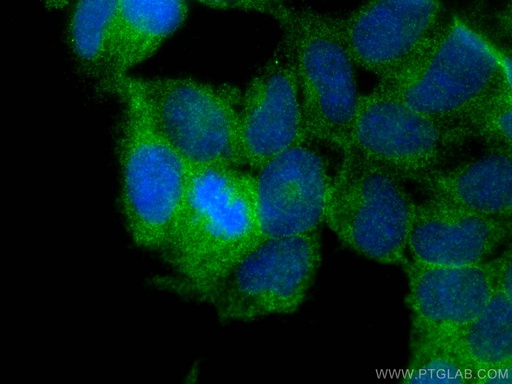 [15109-1-AP-20UL] PHKG2 Polyclonal antibody