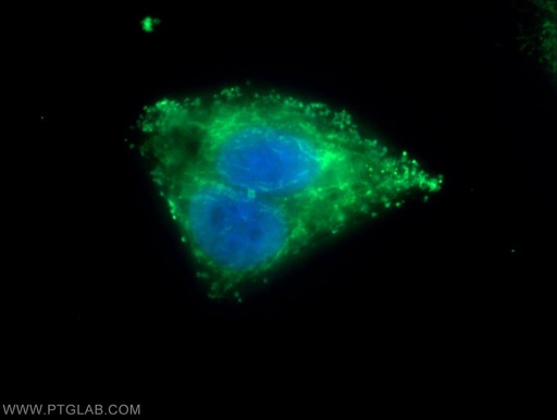 [15120-1-AP-150UL] METTL9 Polyclonal antibody
